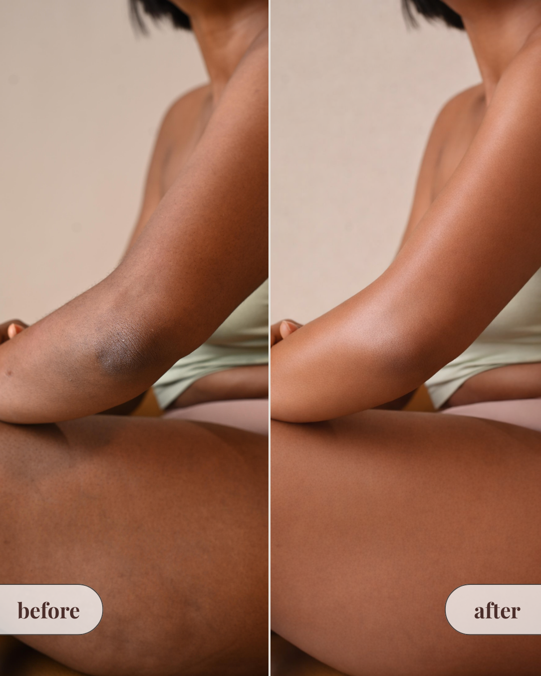 Value Pack - Complete Collection