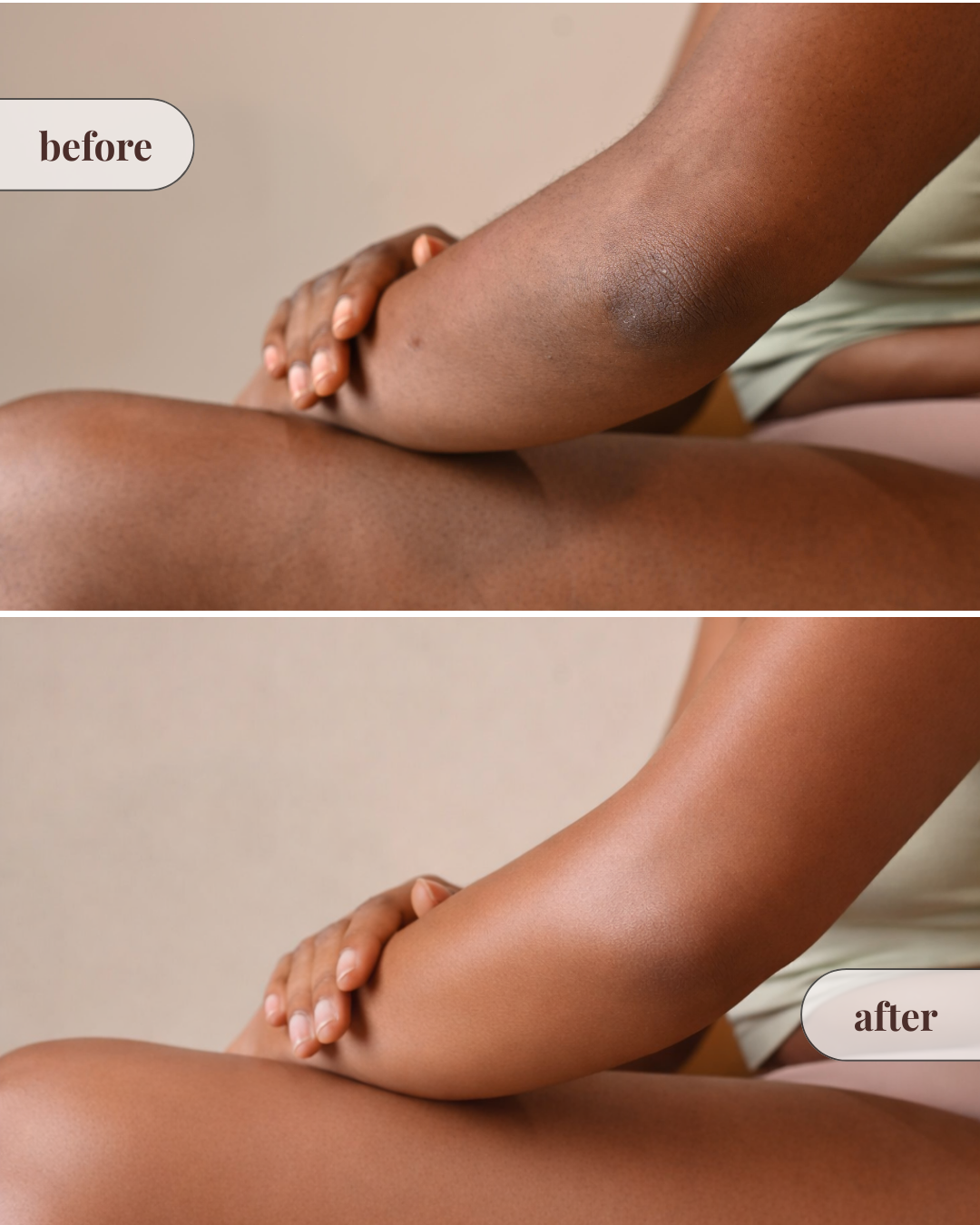 Moisture Seal Duo (Body Butter + Body Oil)